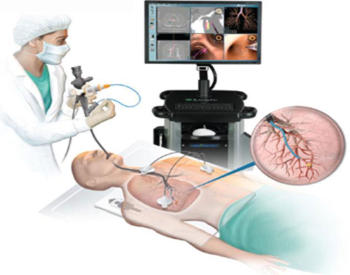 Video bronchoscopy at Niramaya Care Center